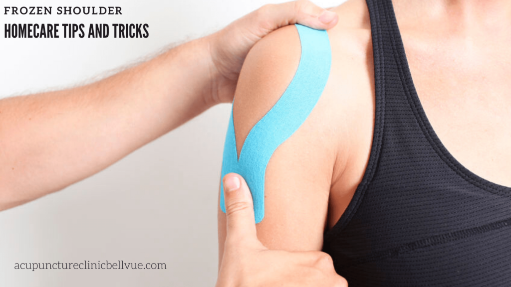 Frozen Shoulder Home Care Tips - Pins and Needles Acupuncture